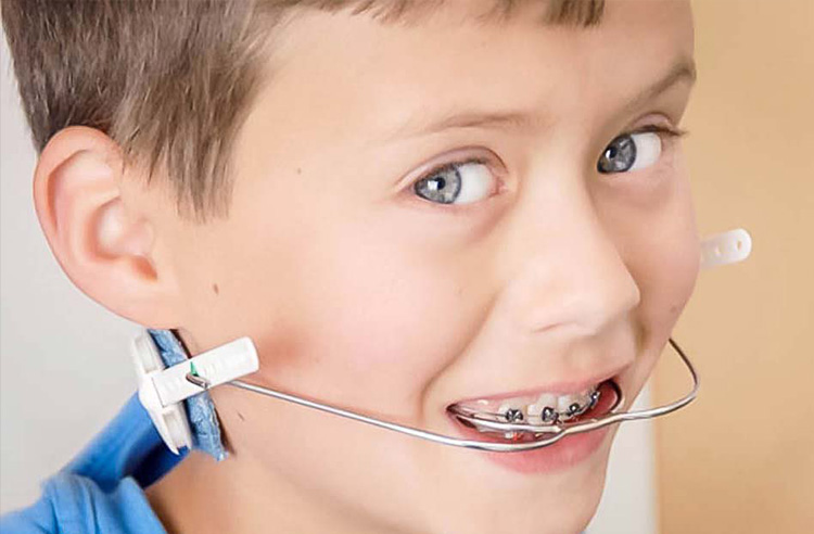 ارتودنسی کودکان
